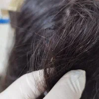 مرکز تخصصی درمان رشک و شپش Ramezani