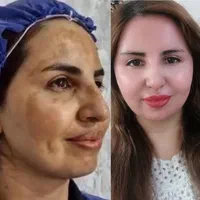 ازبین بردن لک ،کک ومک،جوانسازی