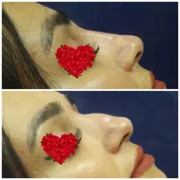 کلینیک ژل آنزیم بینی. لب بوتاکس فیلر و آموزش|خدمات آرایشگری و زیبایی|مشهد, آزادشهر|دیوار