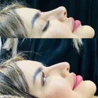 خدمات رایگان تزریق بوتاکس و فیلر،مدل کلینیک زیبایی|خدمات آرایشگری و زیبایی|ارومیه, |دیوار