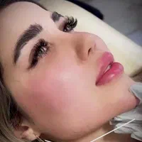 تزریق ژل.بوتاکس.انزیم.چال لپ‌.مزوپیرسینگ|خدمات آرایشگری و زیبایی|فردیس, فردیس|دیوار