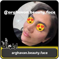 ژل و بوتاکس و آرایش دایم|خدمات آرایشگری و زیبایی|میبد, |دیوار