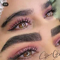 میکروبلیدینگ و فیبروز ابروسبک کرکی مویی سوپرنچرال