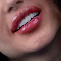 کامپوزیت- لمینیت- ونیر-عصب کشی و پروتز|خدمات آرایشگری و زیبایی|تهران, نارمک جنوبی|دیوار