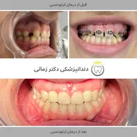 ارتودنسی نامرئی به روش دیجیتالی|خدمات آرایشگری و زیبایی|تهران, امیریه|دیوار
