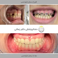ارتودنسی نامرئی به روش دیجیتالی|خدمات آرایشگری و زیبایی|تهران, امیریه|دیوار