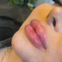 تزریق ژل وبوتاکس عربی،هایفوغبغب،پاک کردن تاتو|خدمات آرایشگری و زیبایی|تهران, نازی‌آباد|دیوار
