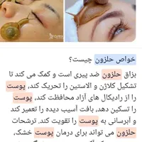 فروش حلزون