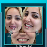 خدمات ترمیم دندان ،مطمین ترین تکنیک های دندانپزشکی|خدمات آرایشگری و زیبایی|شیراز, معالی‌آباد|دیوار