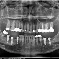 خدمات دندانپزشکی|خدمات آرایشگری و زیبایی|قم, عمار یاسر|دیوار