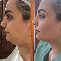 جوانسازی پوست تخفیفات ویژه جشنواره