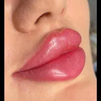 ژل و بوتاکس و لیفت نخ مزوتراپی و آنزیم.فیلربادی|خدمات آرایشگری و زیبایی|کرج, مهرویلا جنوبی|دیوار