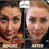 مرکز زیبایی دکتر اسدی (بوتاکس فیلر هایفو مزوتراپی)|خدمات آرایشگری و زیبایی|تهران, نیاوران|دیوار