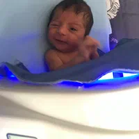 اجاره دستگاهblue light+زردی نوزاد(۲۴h(تمام مناطق|پزشکی|تهران, پرستار|دیوار