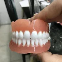 دست دندان مصنوعی طرح لمینت زیبایی تا ۶ ماه اقساط