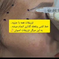 ژل وبوتاکس آموزش صفرتاصد تضمینی باپترو وآزاد|خدمات آموزشی|بندر ماهشهر, |دیوار