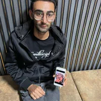 جشنواره کاشت مو