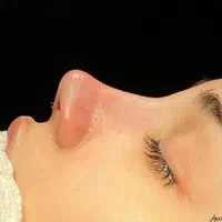 عمل جراحی زیبایی بینی و ترمیم بینی|خدمات آرایشگری و زیبایی|تهران, فلاح|دیوار
