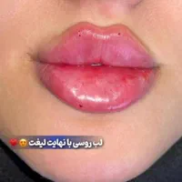 تزریق ژل و بوتاکس تخفیف بهاره ۳۹۹|خدمات آرایشگری و زیبایی|تهران, نازی‌آباد|دیوار