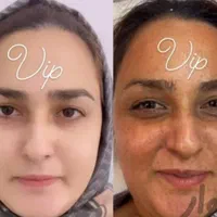 کرم معجزهvipصدرصداصلی ضدلک و روشن کننده|آرایشی، بهداشتی، درمانی|تهران, امام زاده حسن|دیوار