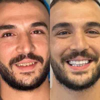 دندان پزشکی اقساطی ۱۲ماهه بدون پیش پرداخت|خدمات آرایشگری و زیبایی|تهران, خانی آباد نو شمالی|دیوار