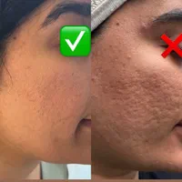 فیشال و خدمات تخصصی پوست توسط پیراپزشک در مطب پزشک|خدمات آرایشگری و زیبایی|مشهد, سجاد شهر|دیوار