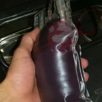 بخیه و تزریقات سرم تراپی و پانسمان در منزل|خدمات آرایشگری و زیبایی|خرم‌آباد, |دیوار