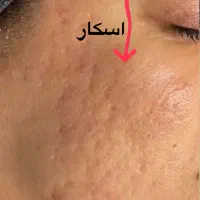 درمان تخصصی ،فیشال و اسیدتراپی و ماساژ درمانی صورت|خدمات آرایشگری و زیبایی|شیراز, رحمت‌آباد|دیوار