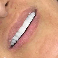 دندانپزشکی.لمینت.ایمپلنت.|خدمات آرایشگری و زیبایی|اصفهان, جلفا|دیوار