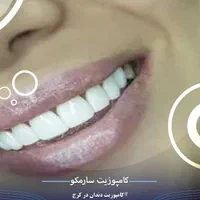 خدمات زیبایی دندان|خدمات آرایشگری و زیبایی|مشکین‌دشت, |دیوار