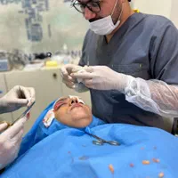 بلفارو پلاستی بدون جای بخیه تضمینی و فیلر و بوتاکس