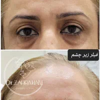 مرکز لیزر و زیبایی دکتر کیانی/ ژل بوتاکس مزو|خدمات آرایشگری و زیبایی|اهواز, کوروش|دیوار