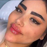 تزریق ژل.بوتاکس.انزیم.چال لپ‌.مزوپیرسینگ|خدمات آرایشگری و زیبایی|فردیس, فردیس|دیوار