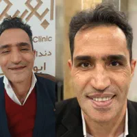 کلیه خدمات دندانپزشکی/اقساط12ماهه/بدون کارمزد|خدمات آرایشگری و زیبایی|قم, حنیف نژاد|دیوار