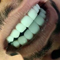 کامپوزیت دندان/ایمپلنت/کلیه امور درمانی و زیبایی|خدمات آرایشگری و زیبایی|اصفهان, کوی ولی عصر|دیوار