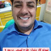 دندان مصنوعی خارجی8 سال ضمانت با بیمه دارای مجوز|خدمات آرایشگری و زیبایی|کرج, مصباح|دیوار