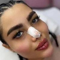تزریق ژل.بوتاکس.انزیم.چال لپ‌.مزوپیرسینگ|خدمات آرایشگری و زیبایی|فردیس, فردیس|دیوار
