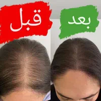 تنها دفتر پخش تونیک هیرفرند گیاهی(ضدریزش، رویش مو)|آرایشی، بهداشتی، درمانی|مشهد, جنت|دیوار