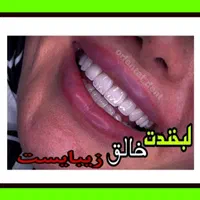 کامپوزیت دندان/دندانپزشکی/ترمیم/عصبکشی/لمینیت