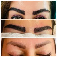 کاشت ابرو،موی دائمی و قابل رشد،مزوprp