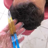 آف ویژه پی آر پی prp ،شادابی و جوانسازی پوست و مو|خدمات آرایشگری و زیبایی|ایلام, |دیوار