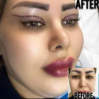 بلفاروپلاستی/ جراحی پلک / لیفت ابرو/ سانترال لب|خدمات آرایشگری و زیبایی|تهران, صادقیه|دیوار