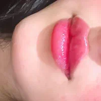 جشنواره تزریق ژل و بوتاکس مزوتراپی مزوژل|خدمات آرایشگری و زیبایی|شیراز, تحویلی|دیوار