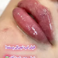 دوره جامع آموزش تزریق ژل،بوتاکس،لیفت نخ وفیلربادی|خدمات آموزشی|شاهین‌شهر, فردوسی|دیوار