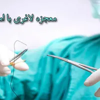 امبیدینگ فقط ۵میلیون وهردستگاه لاغری۱۹۹ هزار تومان
