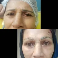 تزریق باسن و بیکینی آموزش جراحی ها توسط جراح|خدمات آموزشی|اهواز, کیانپارس |دیوار