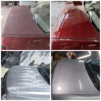 رفع دائم آفتاب سوختگی به ضمانت