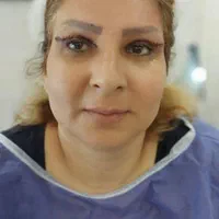 مژده ب همشهریان عزیزم آف چهل درصدی جراحی زیبایی|خدمات آرایشگری و زیبایی|دورود, |دیوار