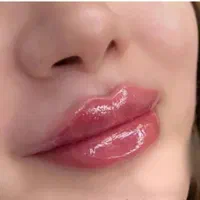 تزریق ژل وفیلر،بوتاکس ،لیزر مطب دکتر دستگیر
