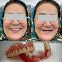 دندانسازی میعاد دندان مصنوعی|خدمات آرایشگری و زیبایی|کرمان, |دیوار